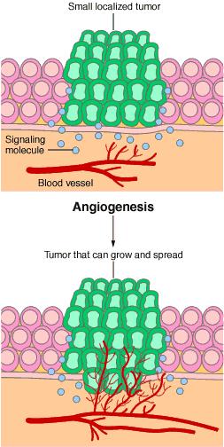 What Is Tumor Angiogenesis?