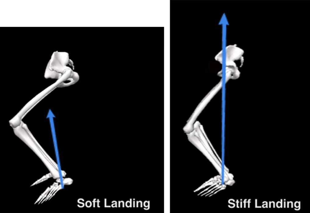 Tuck Jump Assessment Quadriceps dominance Occurs due to imbalance between knee extension (quad)