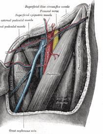 Steps in an AF ablation procedure 1. Vascular access 2. Transeptal puncture 3.