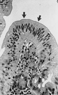 The tip of a villus is lined by tall columnar absorptive cells with elongated nuclei and prominent brush borders (arrows), which are strikingly similar to the absorptive cells lining the small
