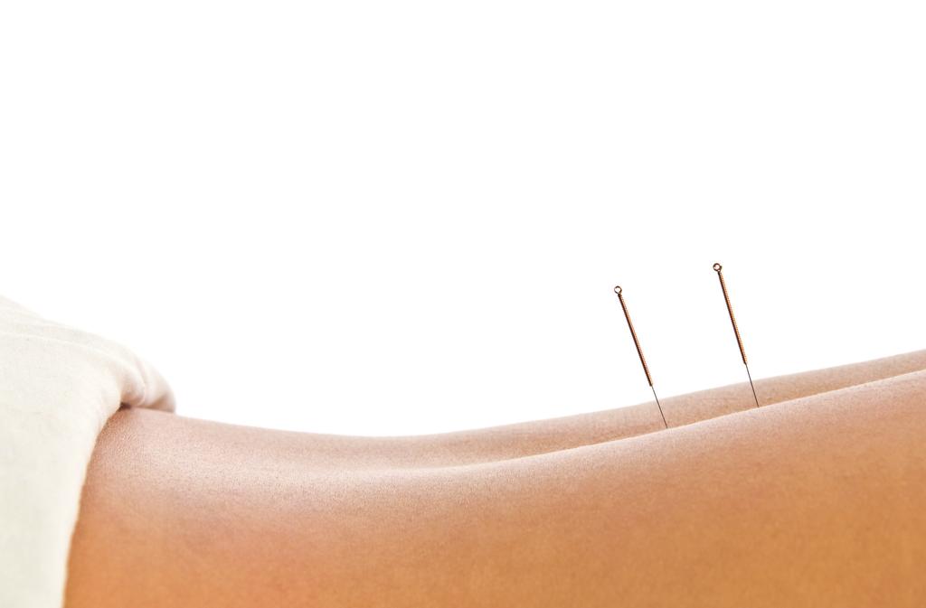 Use of Acupuncture The Institute of Medicine recently identified 79 systematic reviews of acupuncture placing acupuncture third in usage among all complementary and alternative (CAM) therapies.
