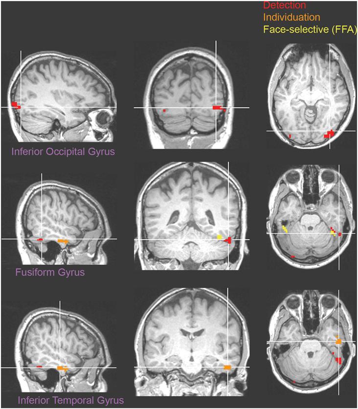 Figure 6. Group map superimposed on the brain of one participant. doi:10.1371/journal.pone.0003978.g006 human visual processing a high correlation would have made this analysis less likely to succeed.