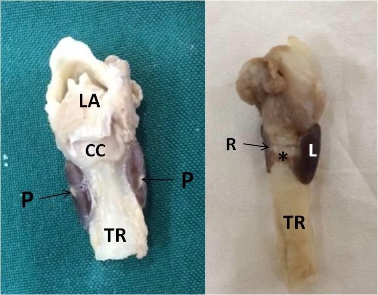 Figure 2: Thyroid Gland of a Female Adult Mongoose with Trachea (TR) and Larynx (LA), Showing Internal Parathyroid Glands (P) in the Thyroid Lobes (Ventral Aspect) CC) Cricoid Cartilage, L) Left