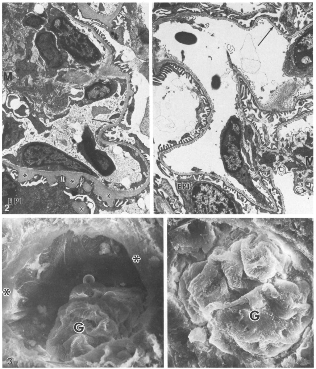 296 M. Rodrigues et al.: Renal and Ocular Changes in Diabetic Mice Fig.2. Transmission electron micrograph of a 6-month diabetic mouse kidney.