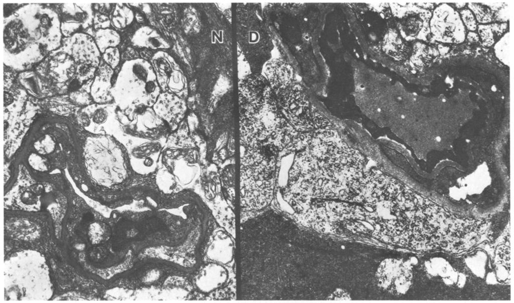 298 M. Rodrigues et al.: Renal and Ocular Changes in Diabetic Mice Fig.6. Transmission electron micrograph of inner retinal vessels.