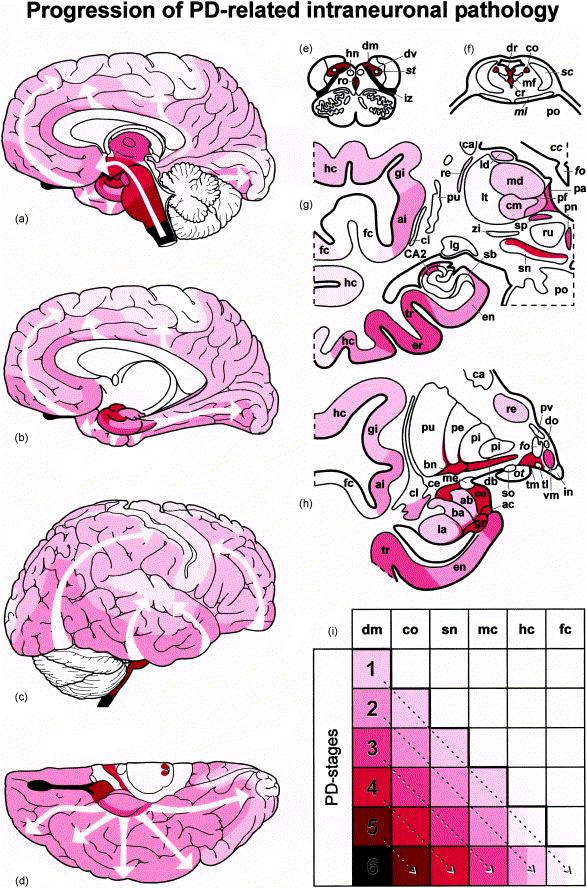 Staging of brain pathology related to sporadic Parkinson s disease Heiko Braak, a, Kelly Del Tredicia, Udo Rüba, Rob A. I. de Vosb, Ernst N. H. Jansen Steurb and Eva Braaka, Neurobiology of Aging.