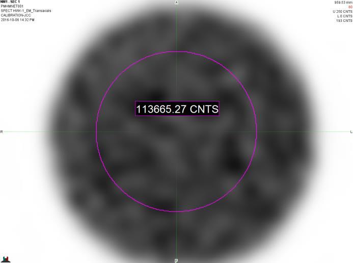 Converting SPECT Counts to MBq x Hr 2 Parts to this challenge Convert Counts to MBq SPECT Sensitivity from Phantom scans