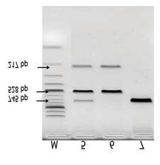 Electrophoresis of a 2% agarose gel with exon 8 PCR product loaded; 1-negative control; 2, 3 and 4-exon 8 fragments with 745 bp. between T2DM subjects and control groups (Table 2).
