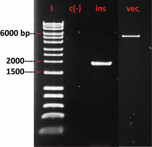 5.4.3 Cloning and Expression of Myrosinase Gene The gene insert was amplified by PCR. The predicted size of the insert was 1998 bp as shown by gel electrophoresis (See Figure 5.3).