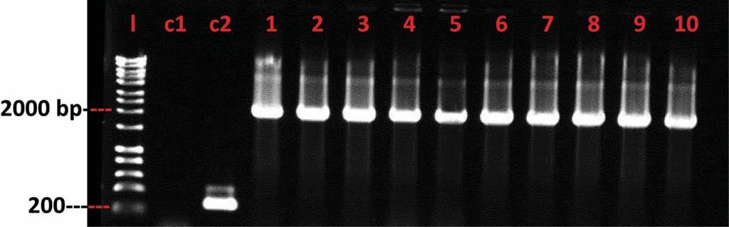 Figure 5.4 Agarose gel electrophoresis for colony PCR experiments. PCR products were run on 1% agarose gel.
