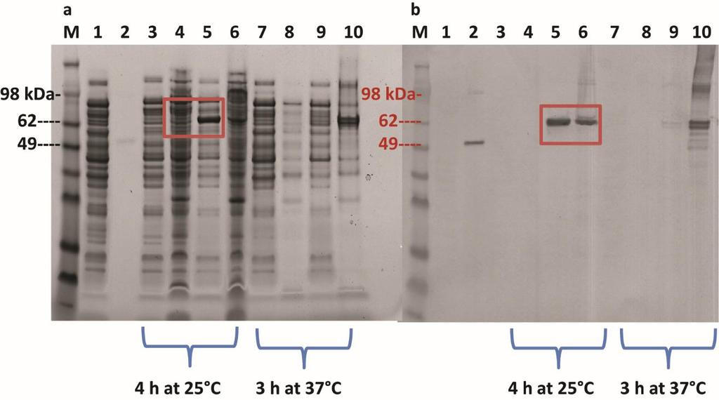Figure 5.6 SDS-PAGE of soluble and insoluble extracts from E. coli BL21(DE3) expressing pet28b-cmyr.