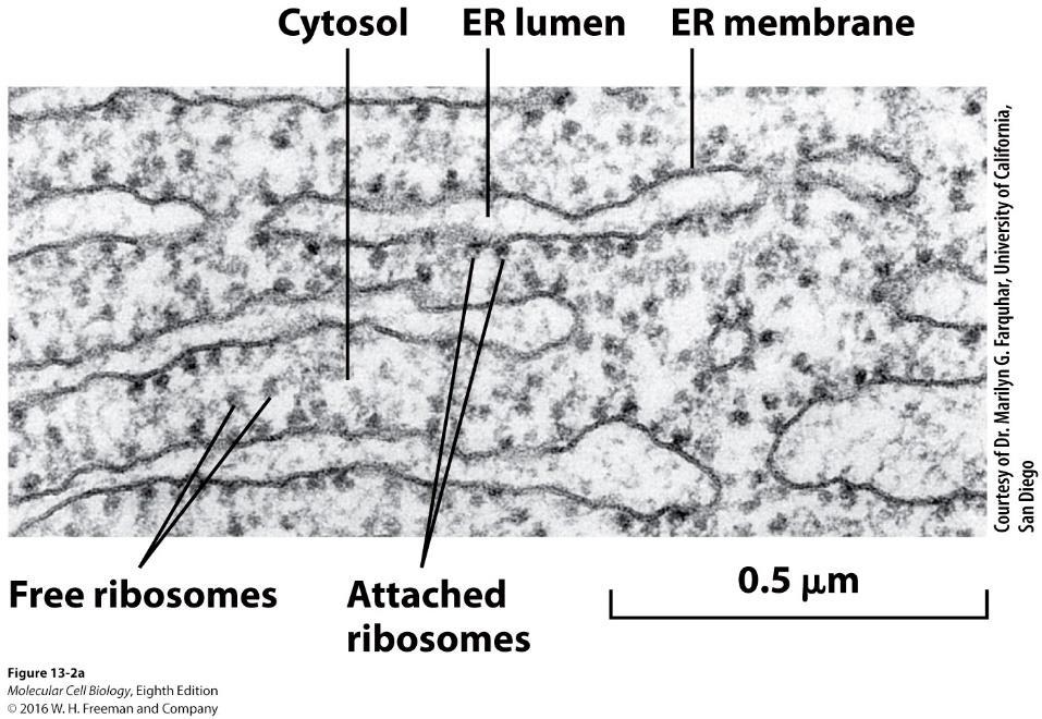 Protein synthesis on the ER: ER membrane-bound and free