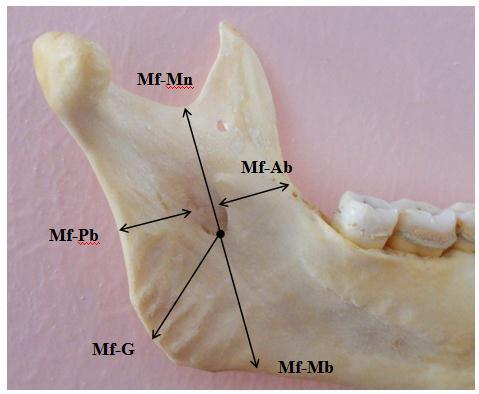 TABLE :2 Metric measurements of the mandibular ramus and mandibular foramen. Measurements (mm) side Mean ± SD Total Mean ± SD Ab-Pb (width of ramus) 32.1 ± 3.8 31.9 ± 3.8 31.6 ± 3.