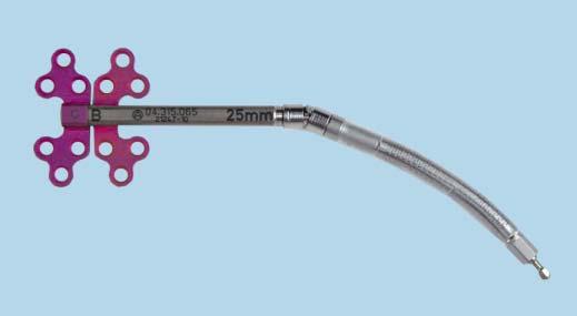 Micrognathia Secondary to Pierre Robin Sequence Product information 04.315.065 BC Distractor Body End Activated with U-Joint, 25 mm for CMF Distractor 04.315.312 1.