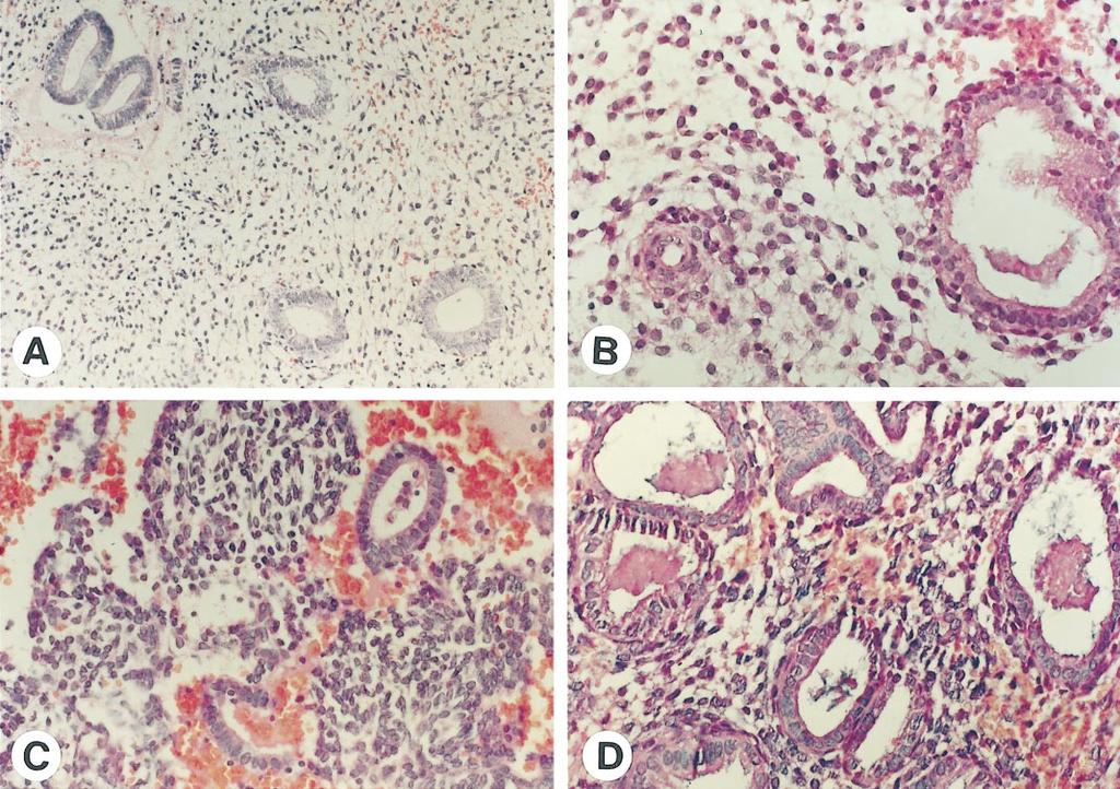 L.Devoto et al. Figure 4. Histology of the endometrium in Uniplant users at different phases of their ovarian cycles. Original magnification: (A) 200; (B), (C) and (D) 400.