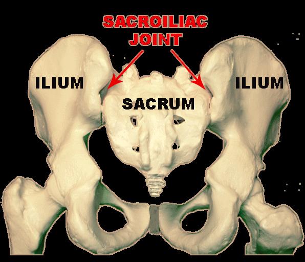 Diagnosing SI Joint Dysfunction (Sacroiliac Joint) Sciatica is a condition where the sciatic nerve is being irritated by structures around it.