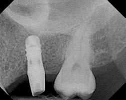 32. A radiograph is