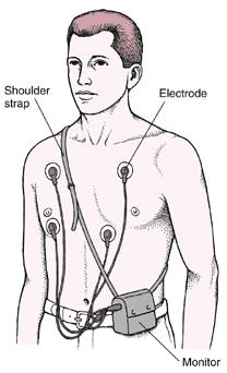 Electrocardiogram -(ECG) a.
