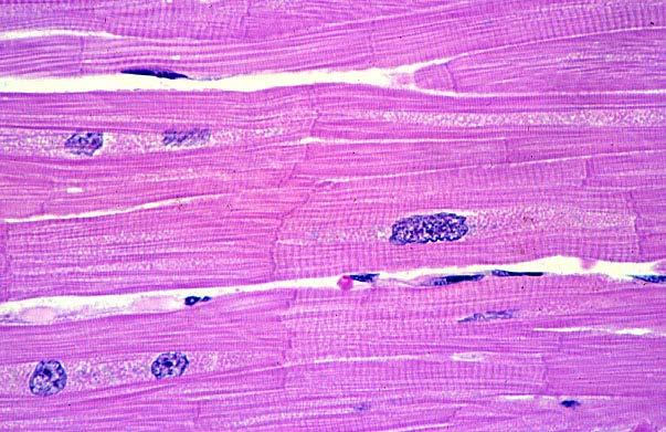 There are differences between skeletal and cardiac muscle Skeletal muscle Elongated multi-nucleated cells