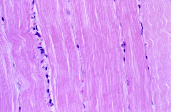 shape Mono-nucleated or bi-nucleated Nuclei located centrally in the cell Often branched Important to