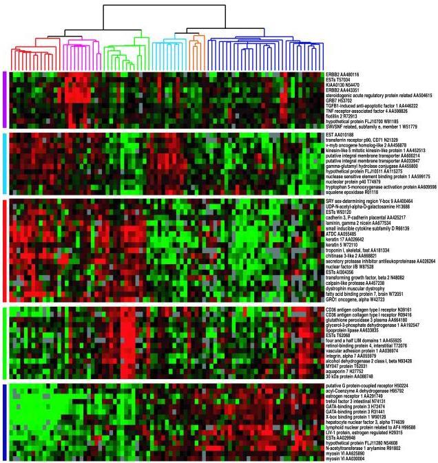 Subtypes of IDC with gene expression Nature. 2000 Aug 17;406(6797):747-52.