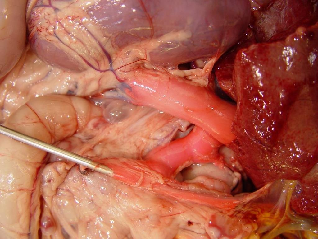 Congenital portosystemic shunts CIRCULATORY DISTURBANCES Other Vascular / Circulatory Disorders Pathologic Basis of