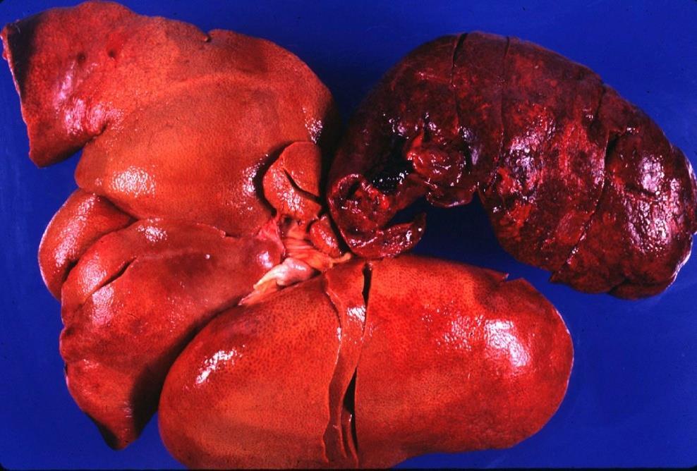 Infarction, shock and death may occur Secondary to mycotic rumenitis Hepatic