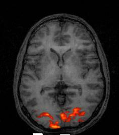 fmri changes in cerebral blood flow based on how hemoglobin/o 2 affects protons.