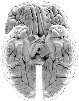 1. Topography Gyri, Sulci, Fissures and Lobes on: