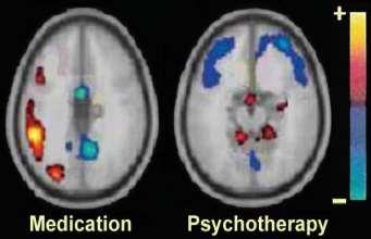 Does Treatment Work? Medications + psychosocial therapy both benefit brain function and recovery.