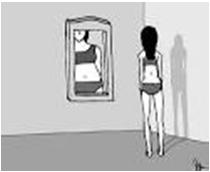 Eating Disorders DSM 5 Anorexia Nervosa (AN) Bulimia Nervosa (BN) Binge Eating Disorder What do you think of when I say eating disorder Anorexia Nervosa 9 Division of Adolescent & Young Adult