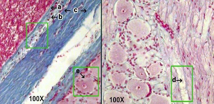 a pia mater b subarachnoid space c dura mater d myelinated axon e unipolar