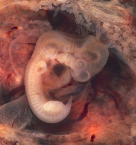 Embryo Lasts about 6 weeks.