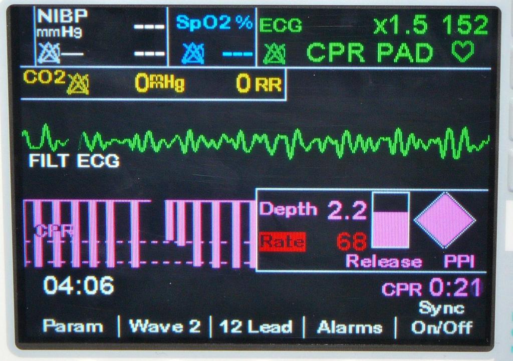 CPR Process Defibrillator dashboard with CPR process measures