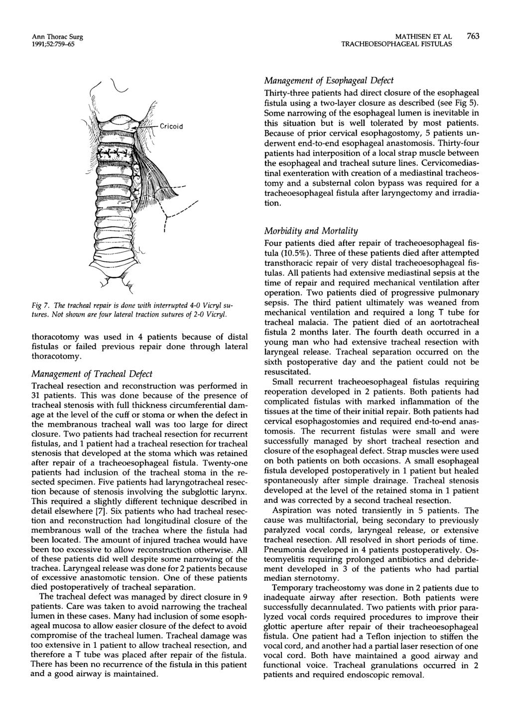 Ann Thorac Surg 1991;52759-65 MATHISEN ET AL 763, Management of Esophageal Defect Thirty-three patients had direct closure of the esophageal fistula using a two-layer closure as described (see Fig 5).