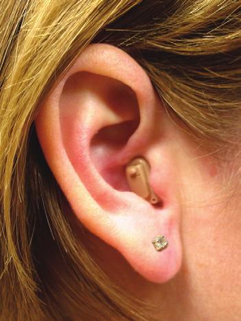 hearing loss.