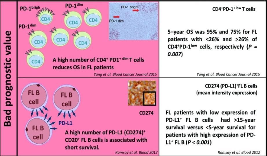 Follicular Lymphoma (FL) PD-L1 is rarely expressed on FL tumor cells FL microenvironment contains many types of T cells that can express