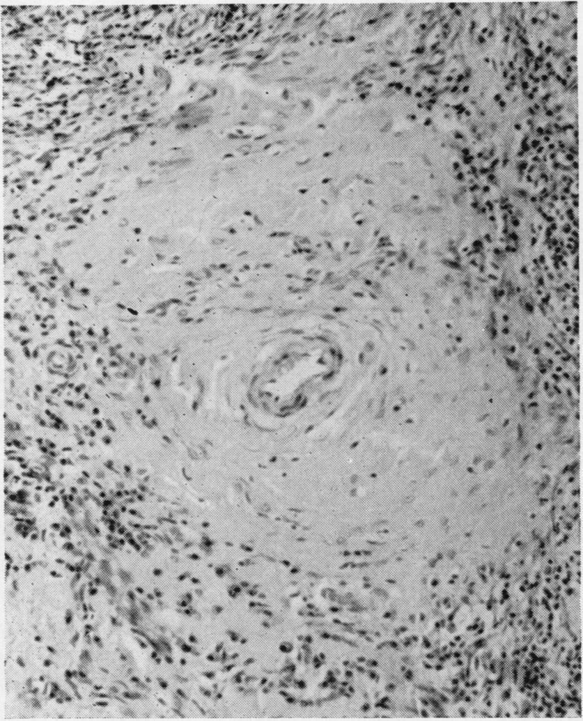 A J Clin Pathol: first published as 10.116/jcp.21..0 on 1 May 1968. Downloaded from http://jcp.bmj.com/.? FIG. B. -Al FIG.
