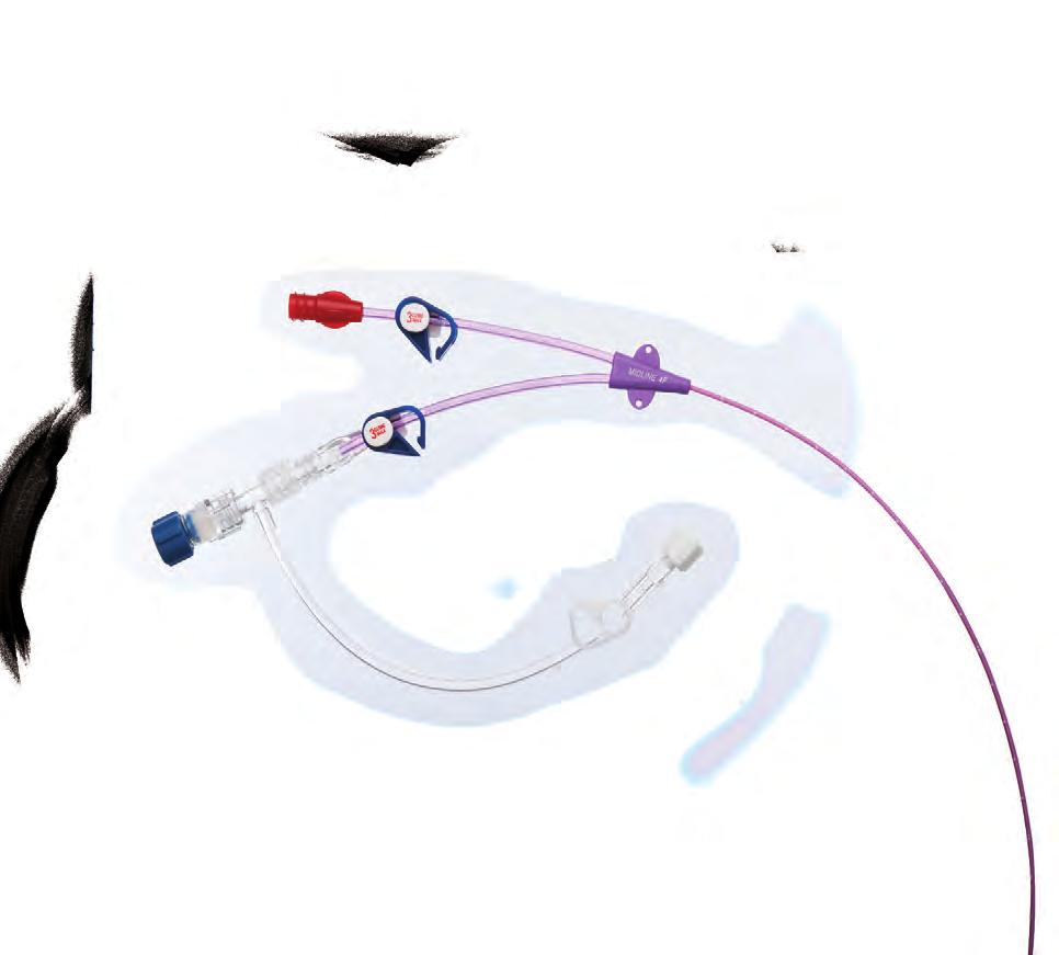 Single and Dual lumen CT Midline catheters with pre-loaded flushable stylet Clearly marked Midline identifiers Power injectable Midline
