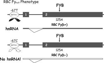 GATA binding site mutation Single nucleotide mutation in the FY*B gene promoter prevents