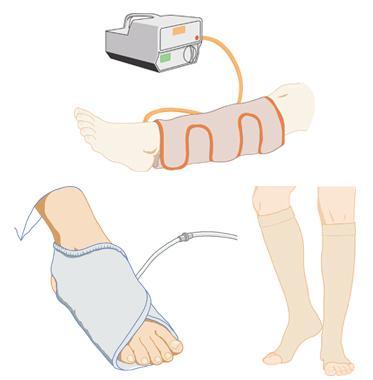 Supporting Evidence Improperly fitted compression stockings producing a reversed pressure gradient were