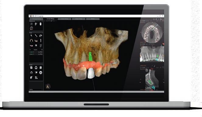process as you scan abutments or scanbodies Smart technology allows you to scan the patient s arch, cut the region and then place the scanbody rescanning only that specific