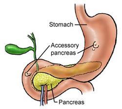 Anular pancreas; a thin flat band of pancreatic tissue