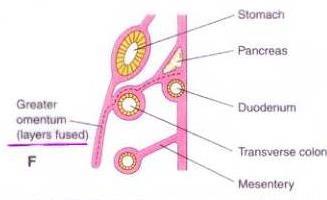 Fixation of various parts of intestines The enlarged