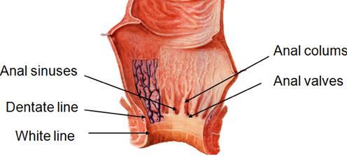 Lower 1/3 of anal canal is lined superiorly by a stratified squamous nonkeratinized epithelium (zona hemorrhagica).