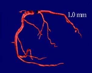 Quantification of myocardial perfusion Spatial