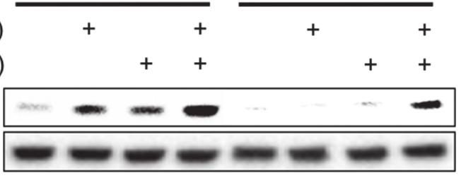 Supplement material H46: si-sc H46: si-p53 p53 GAPDH Figure S1 Western blot result shows p53