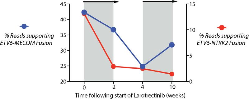 Clinical response to larotrectinib in ETV6-NTRK2 AML Rapidly rising WBC.