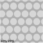 surface density of glands Morphometry - Baak et al Lesions with a volume percentage stroma (VPS) of less than 55% are