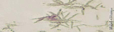 the malaria parasites. Figure 13.